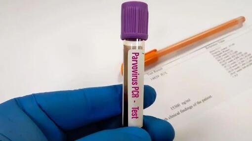 Test de depistare a parvovirozei